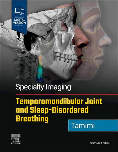 Specialty Imaging: Temporomandibular Joint and Sleep-disordered Breathing 2nd Edition