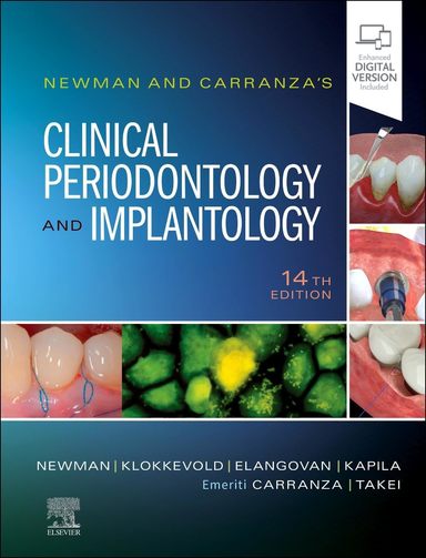 Newman & Carranzas Clinical Periodontology & Implantology