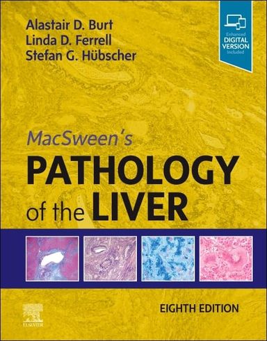 Macsweens Pathology Of The Liver