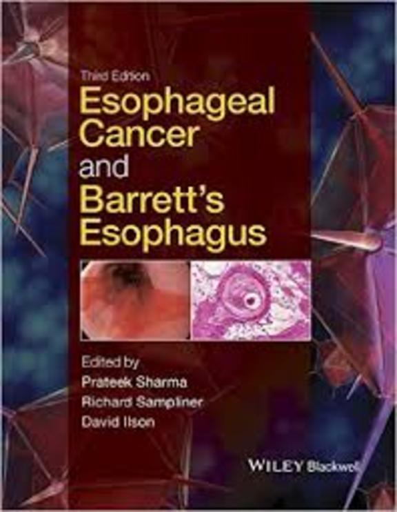 Esophageal Cancer and Barrett's Esophagus