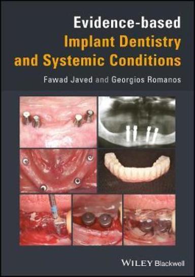 Evidence-Based Implant Dentistry and Systemic Conditions