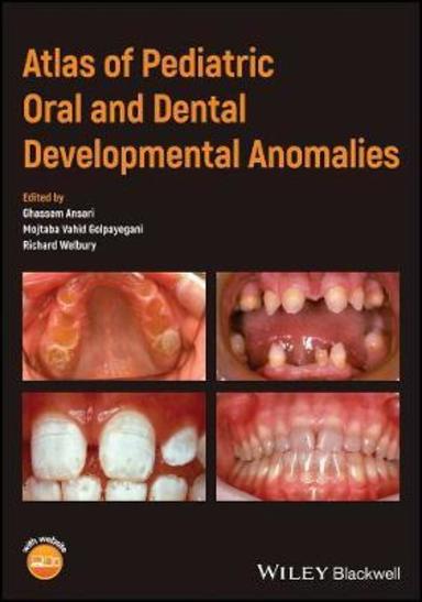 Atlas of Pediatric Oral and Dental Developmental Anomalies
