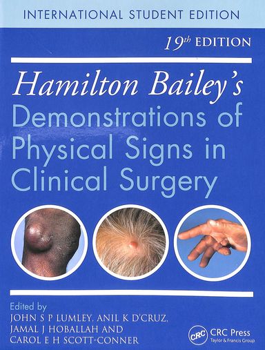 Hamilton Baileys Demonstrations Of Physical Signs In Clinical Surgery