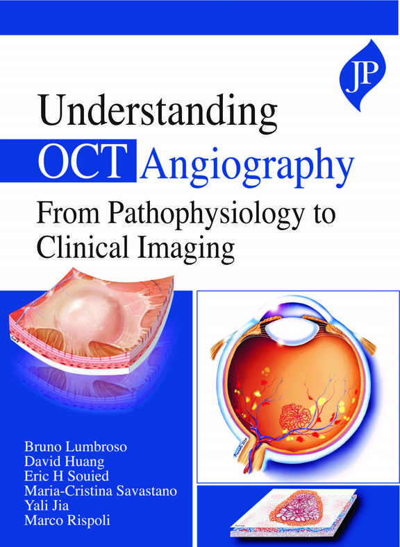 Understanding OCT Angiography From Pathophysiology to Clinical Imaging
