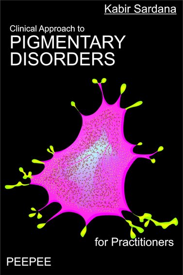 Clinical Approach to Pigmentary Disorders