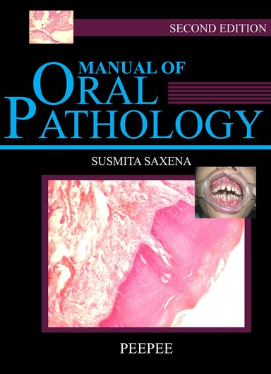Manual of Oral Pathology 2nd Edition
