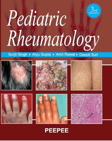 Pediatric Rheumatology 3rd Edition