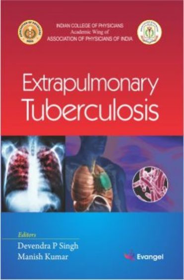Extrapulmonary Tuberculosis