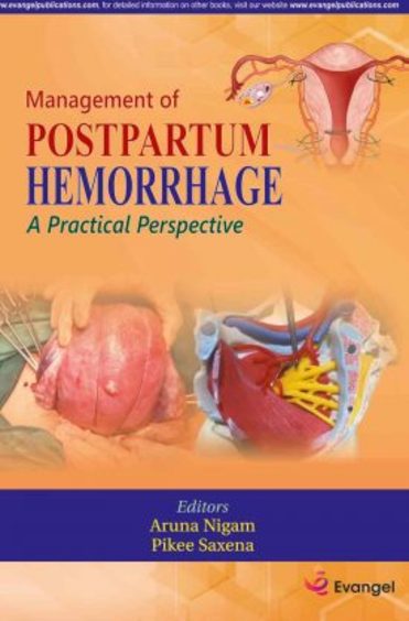 Management Of Postpartum Hemorrhage: A Practical Perspective