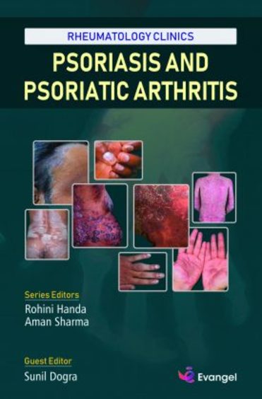 Rheumatology Clinics: Psoriasis and Psoriatic Arthritis