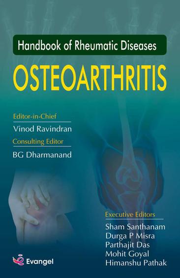 Handbook of Rheumatic Diseases: Osteoarthritis
