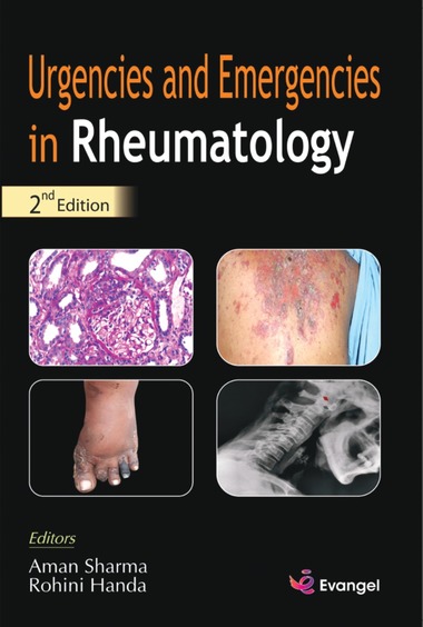 Urgencies and Emergencies in Rheumatology