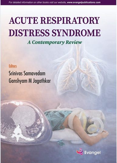 Acute Respiratory Distress Syndrome: A Contemporary Review