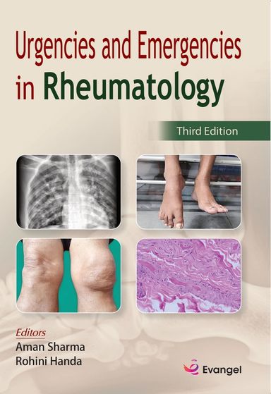 Urgencies and Emergencies in Rheumatology