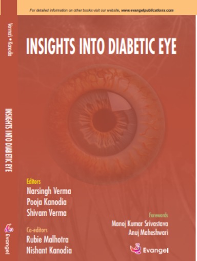 Insights into Diabetic Eye