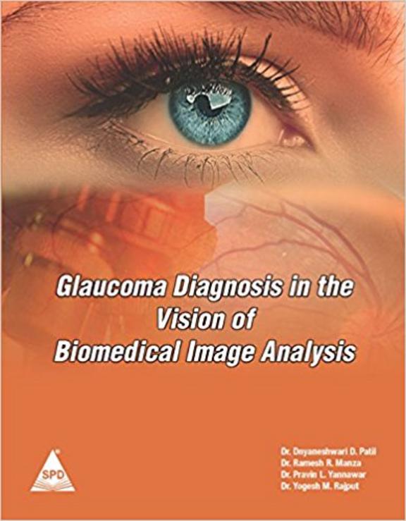 Glaucoma Diagnosis in the Vision of Biomedical Image Analysis