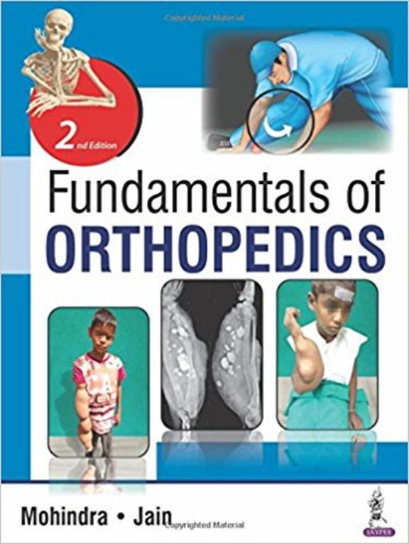 Fundamentals Of Orthopedics
