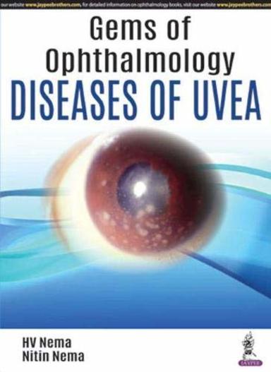 Gems in Ophthalmology : Diseases of Uvea