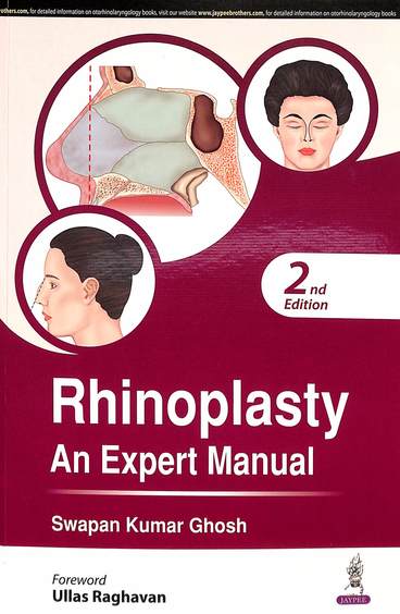 Rhinoplasty An Expert Manual
