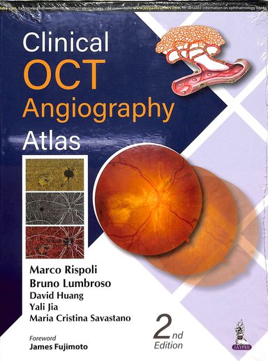 Clinical Oct Angiography Atlas