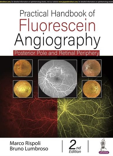 Practical Handbook Of Fluorescein Angiography