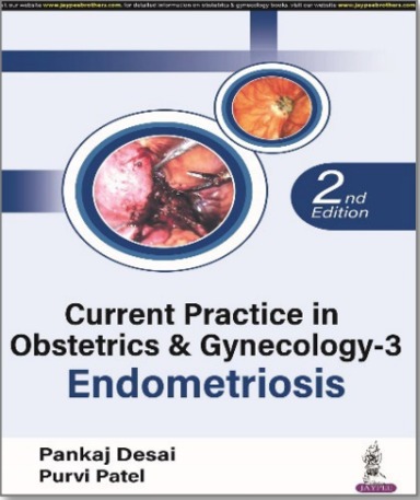 Current Practice In Obstetrics & Gynecology - 3 Endometriosis