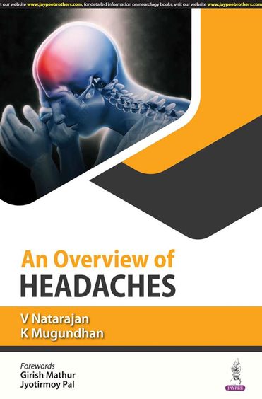 On Overview Of Headaches
