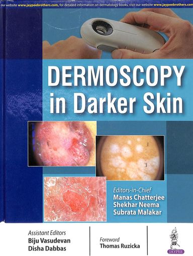 Dermoscopy In Darker Skin