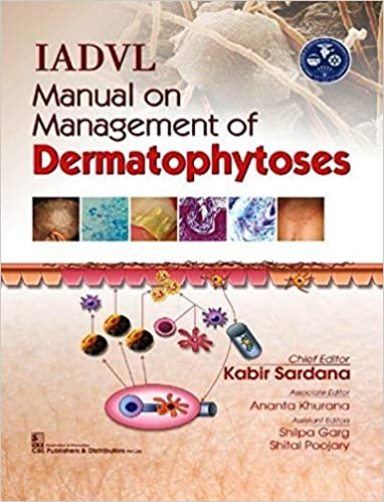 IADVL Manual on Management of Dermatophytoses