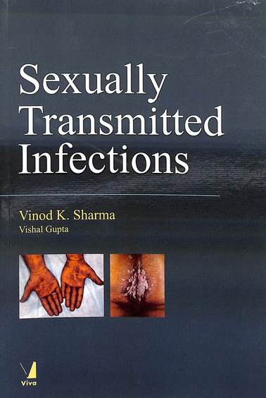 Sexually Transmitted Infections