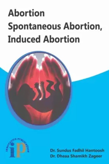 Abortion Spontaneous Abortion, Induced Abortion