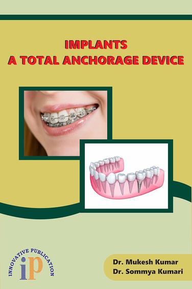 Implants - A Total Anchorage Device