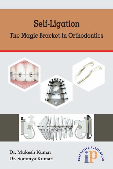 Self-Ligation - The Magic Bracket in Orthodontics