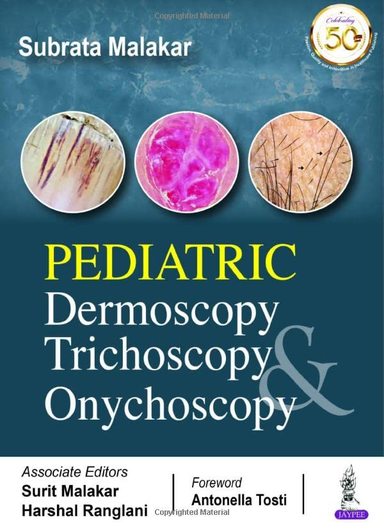Pediatric Dermoscopy, Trichoscopy and Onychoscopy