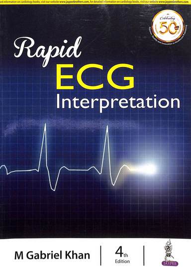 Rapid Ecg Interpretation
