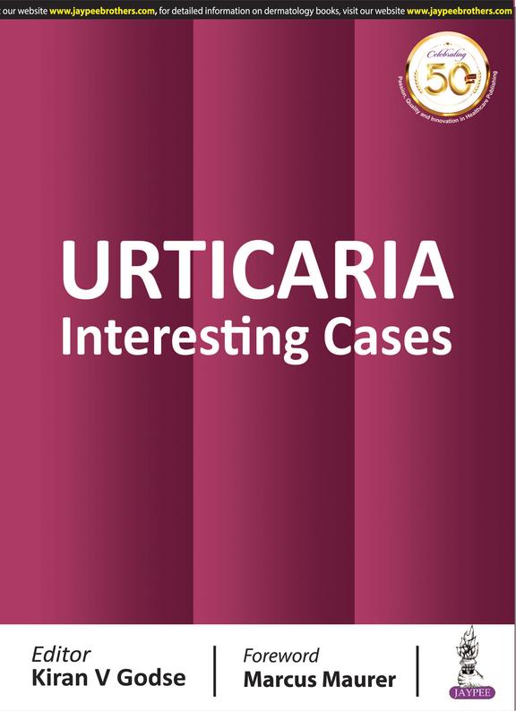 URTICARIA Interesting Cases
