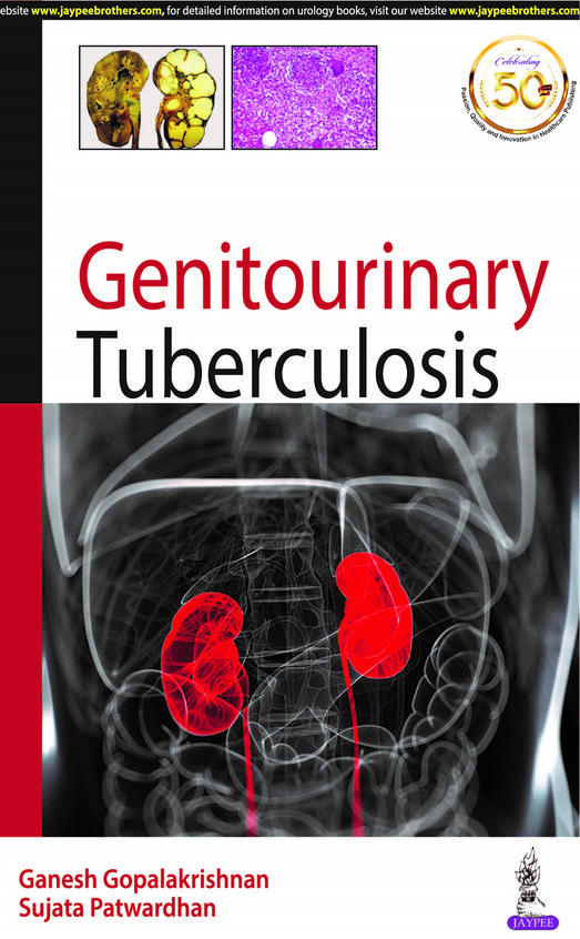 Genitourinary Tuberculosis
