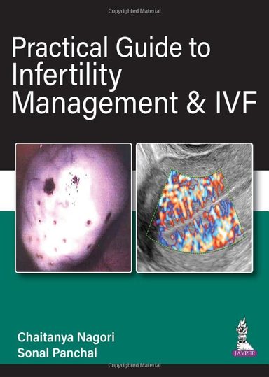 Practical Guide to Infertility Management and IVF