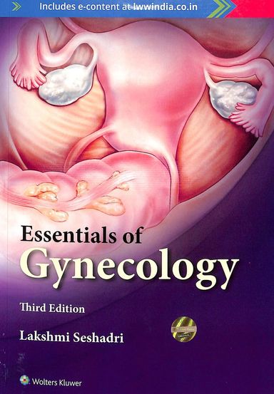 Essentials Of Gynecology