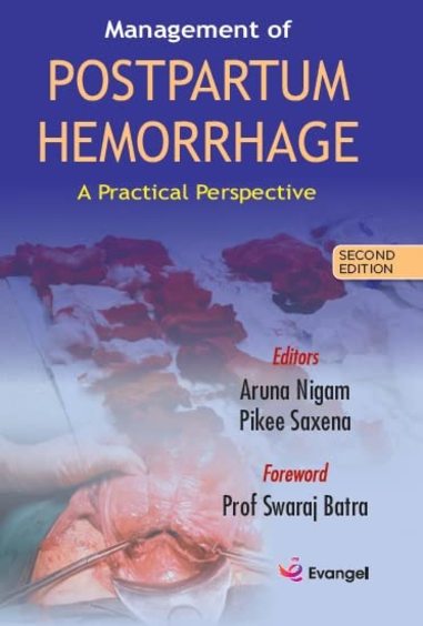Management of POSTPARTUM HEMORRHAGE A Practical Perspective 2nd edition