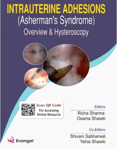 Intrauterine Adhesions (Ashermans Syndrome)