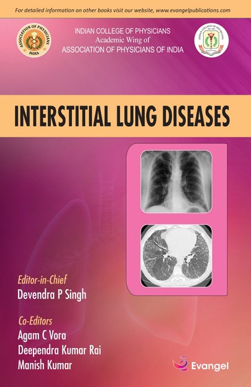 Interstitial Lung Disease