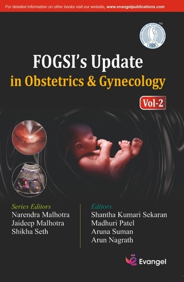 FOGSIs Update in Obstetrics and Gynecology Vol 2