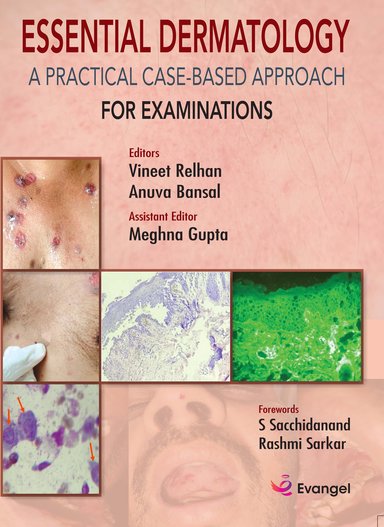 Essential Dermatology : A Practical Case Based Approach For Examinations