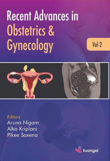 Recent Advances In Obstetrics & Gyneclogy Vol 2