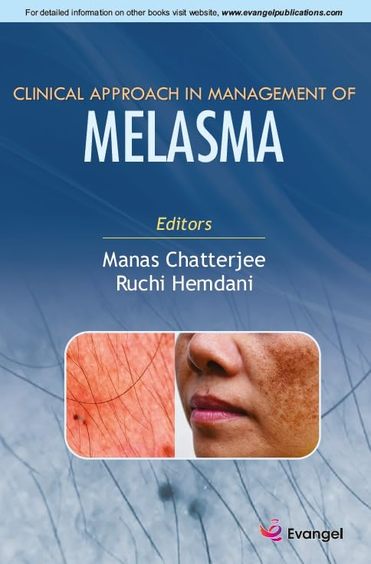 Clinical Approach in Management of MELASMA